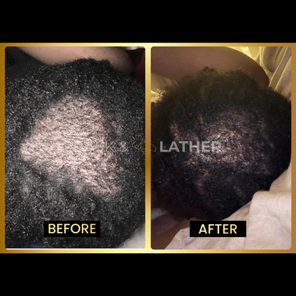 Scalp Stimulator | Hair Growth Oil